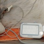 Provides mobile monitoring of patients both under anaesthesia during surgery but because it is mobile, it travels with the patient so they can be monitored during recovery.
